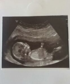 Hand Made Silver Baby Scan Charm - Image 2